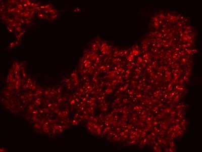 Stem cells stained for SSEA4