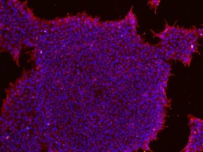 Stem cells stained for SSEA4 and DAPI