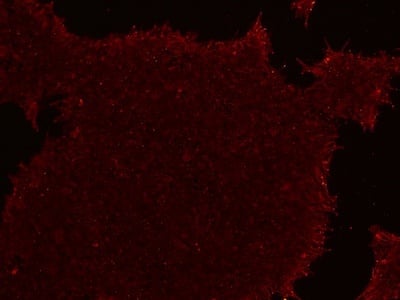 Stem cells stained for SSEA4