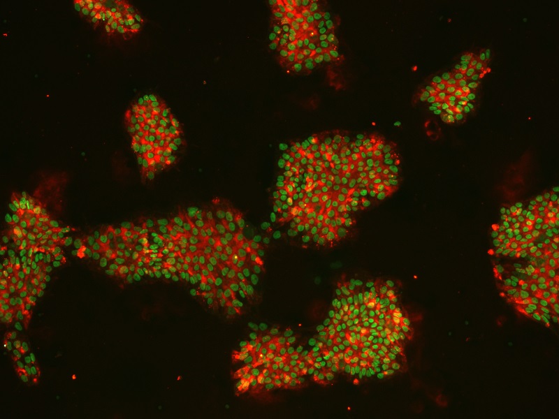 Double Staining 2_BT17110KMC13 A1 NANOG TRA160 1% X10 GFP 594-1