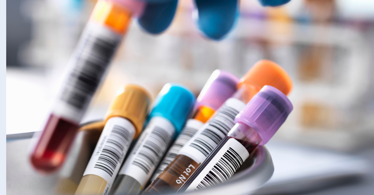 Inside the Sample Lifecycle: How Central Labs Protect Data from ...