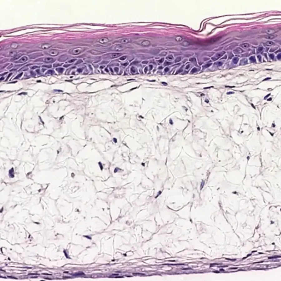 REPROSKIN™ Full Thickness Human Skin Equivalent