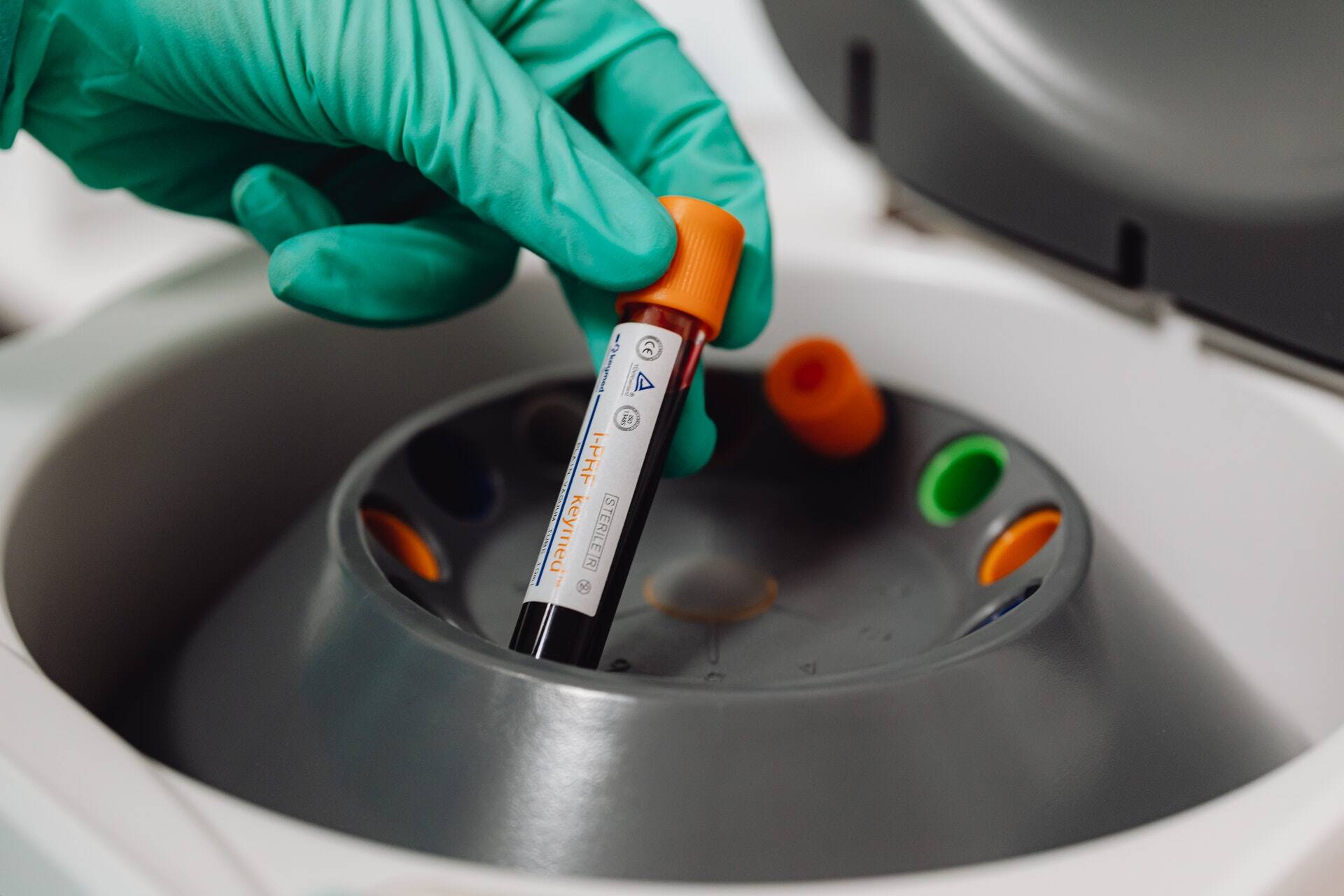 Peripheral Blood Mononuclear Cells as Translational Tools in Drug Development